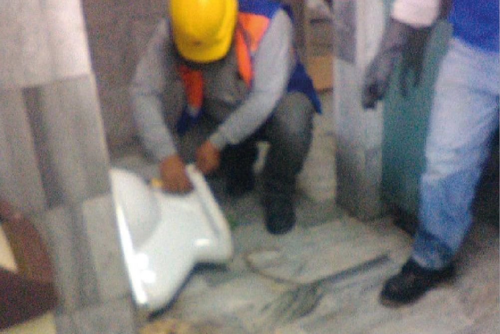 Colocación de anillo de cera